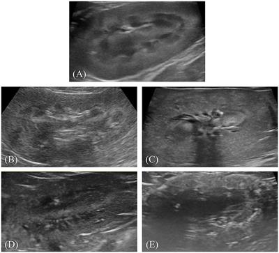 Deep learning-based ultrasonographic classification of canine chronic kidney disease